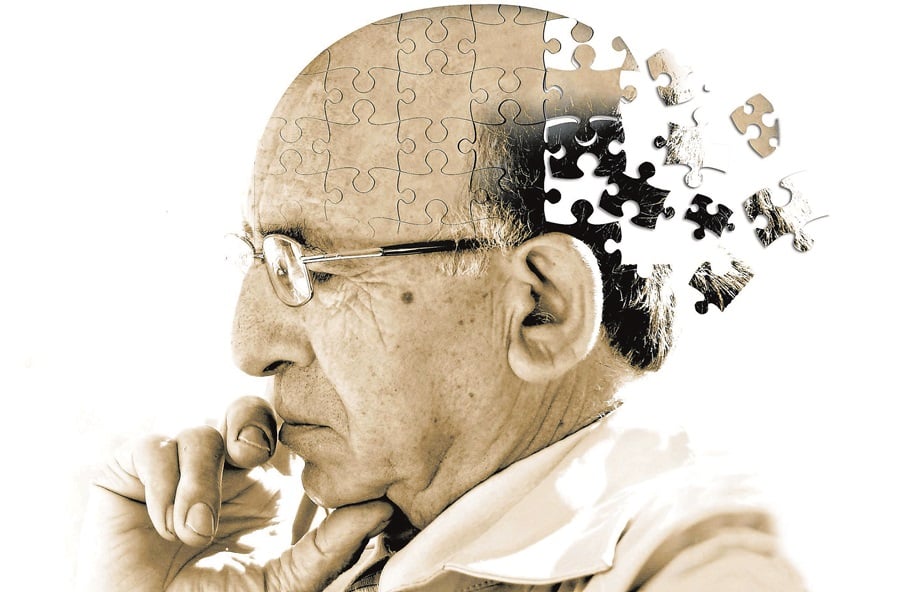 The Stages of Alzheimer’s Disease